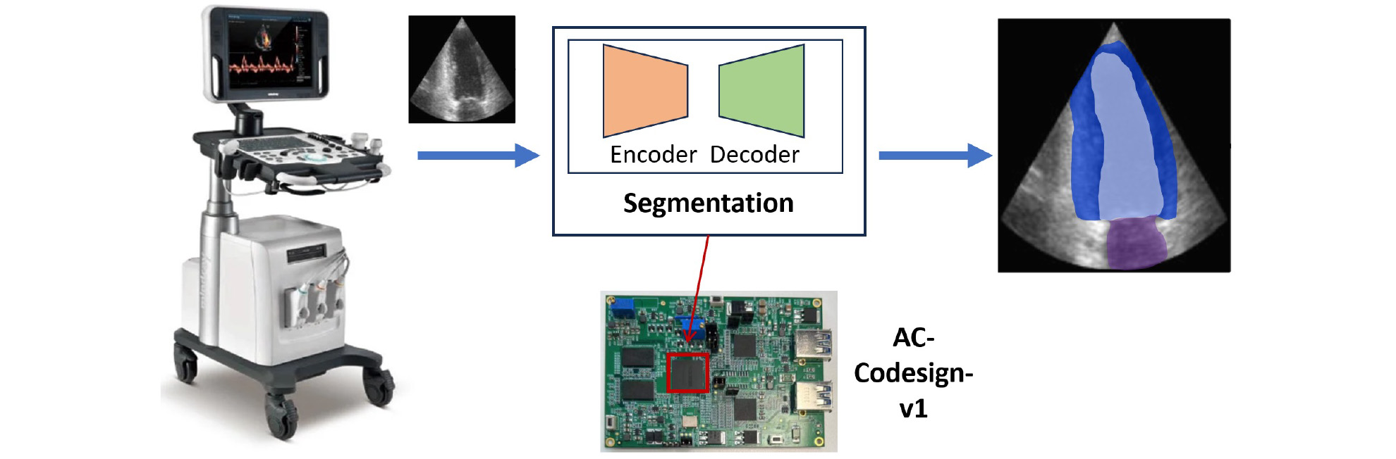 Real-Time Image Segmentation of Ultrasound Imaging to Assist Cardiac Disease Evaluation